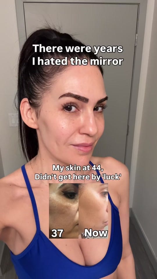 Post 7 by Sarit | Melasma Expert on TikTok (video)
