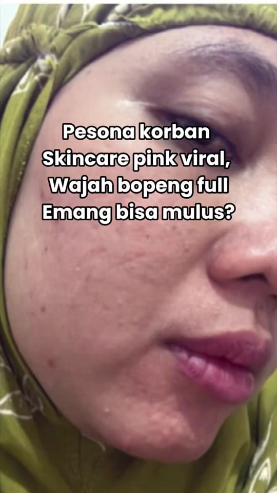 Post 8 by DRW Skincare Real on TikTok (video)