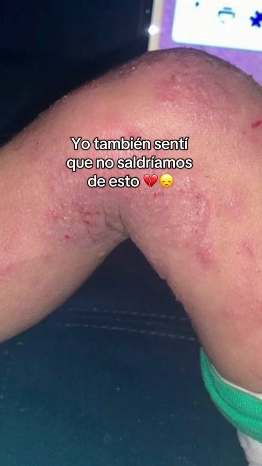 Post 9 by Scrachee Puerto Rico & USA on TikTok (video)