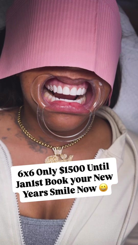 Post 4 by Houston Smile Designs on TikTok (video)