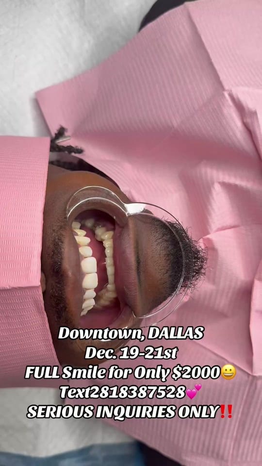 Post 5 by Houston Smile Designs on TikTok (video)