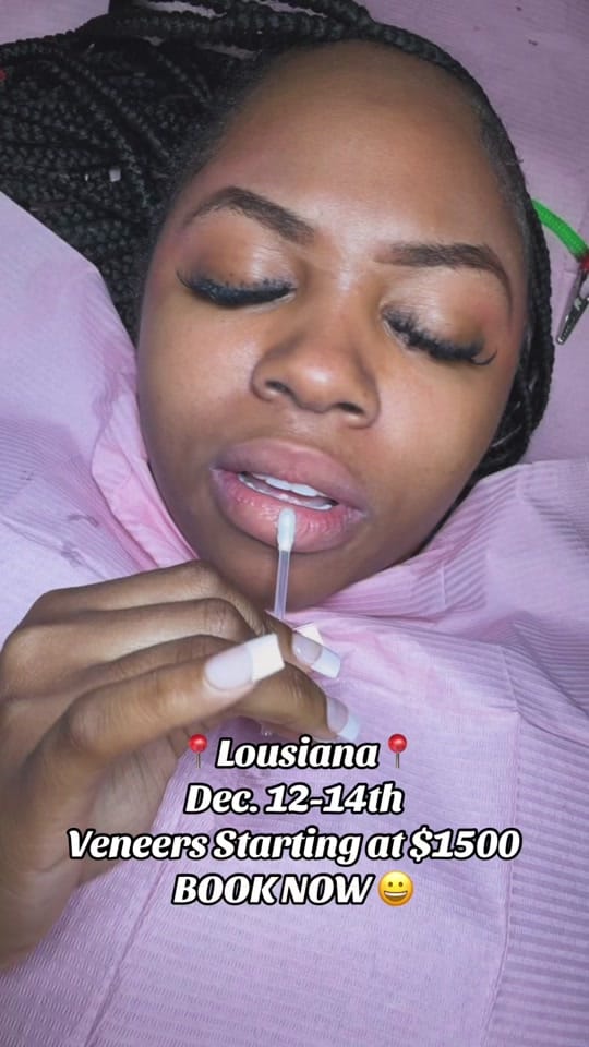 Post 6 by Houston Smile Designs on TikTok (video)