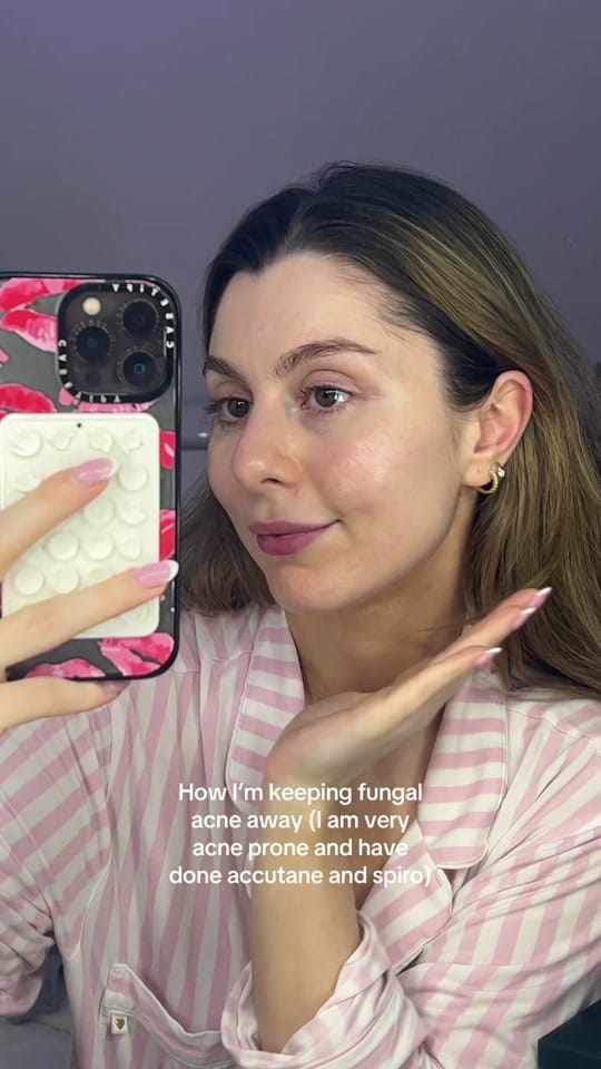 Post 6 by izabel on TikTok (video)
