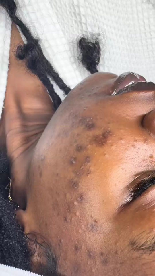 Post 5 by toptierglow_estheticslounge on TikTok (video)