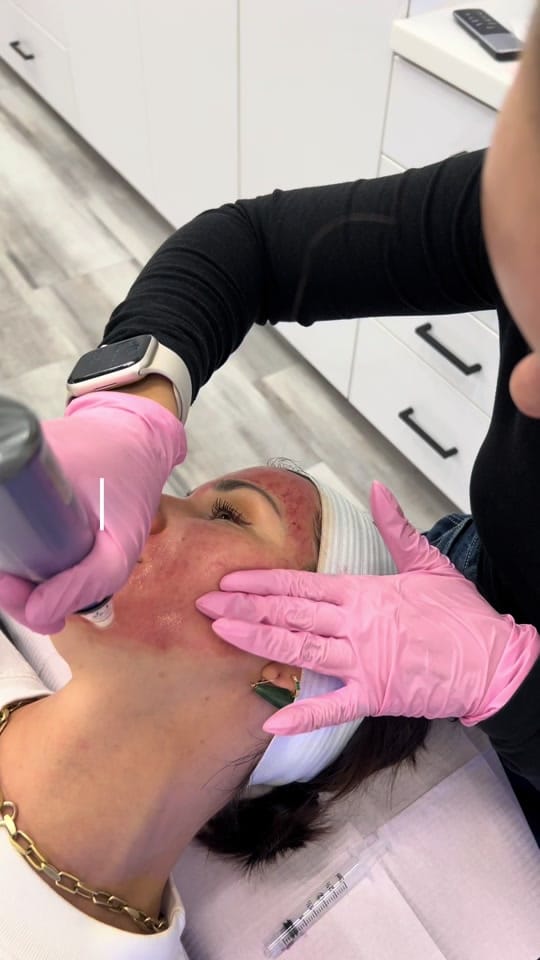 Post 3 by Beauty Lab + Laser on TikTok (video)