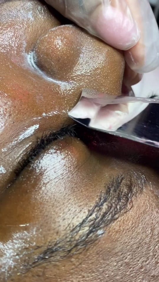 Post 10 by SKINBYDI on TikTok (video)