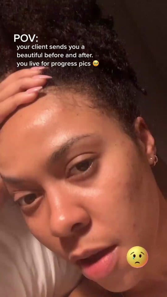 Post 6 by SKINBYDI on TikTok (video)