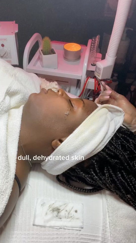 Post 9 by SKINBYDI on TikTok (video)