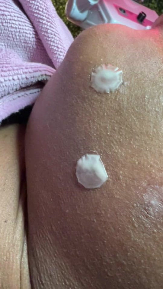 Post 4 by SKINBYDI on TikTok (video)