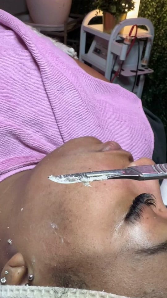 Post 7 by SKINBYDI on TikTok (video)