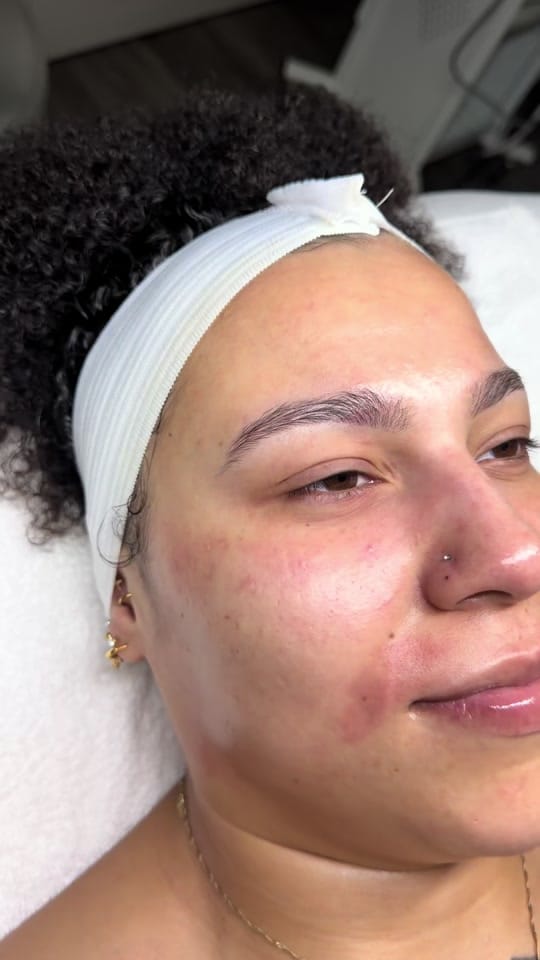Post 4 by Serenity Esthetixs on TikTok (video)