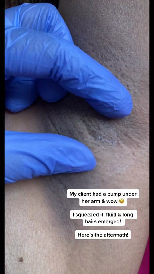Post 8 by Serenity Esthetixs on TikTok (video)