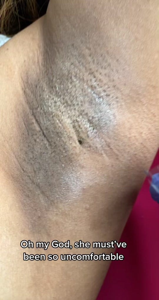 Post 10 by Serenity Esthetixs on TikTok (video)
