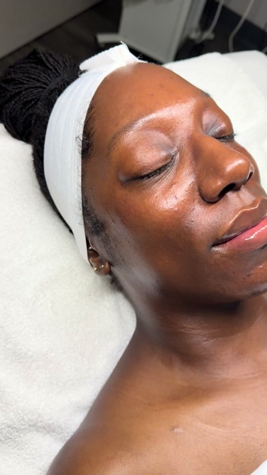 Post 5 by Serenity Esthetixs on TikTok (video)