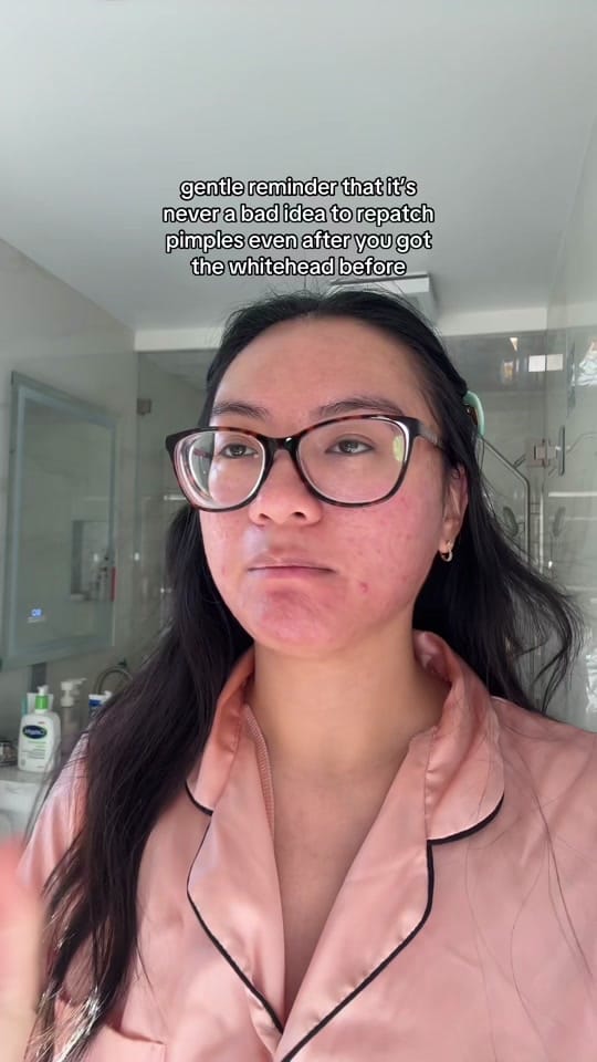 Post 8 by jennilee • thatacnegirlie on TikTok (video)