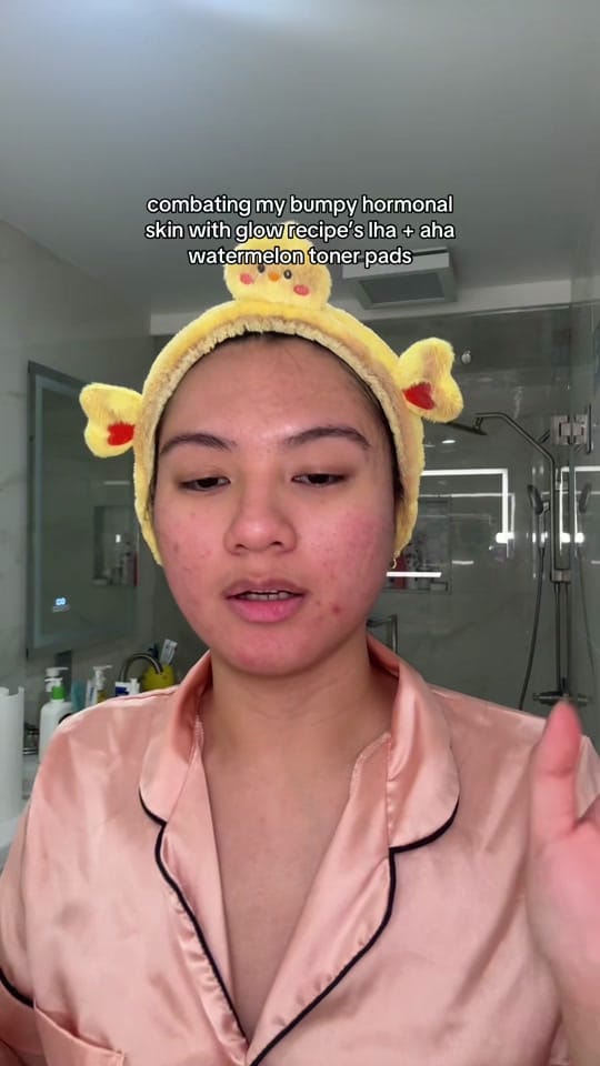 Post 5 by jennilee • thatacnegirlie on TikTok (video)