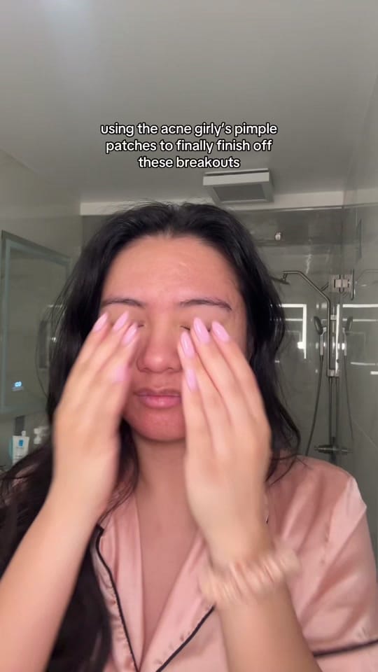 Post 7 by jennilee • thatacnegirlie on TikTok (video)