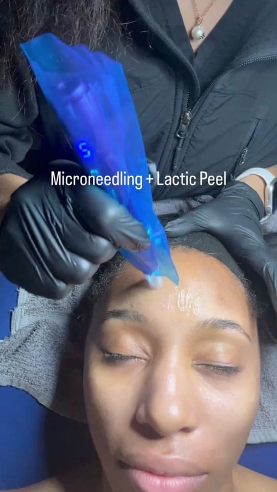 Post 4 by skinappeal_ on TikTok (video)
