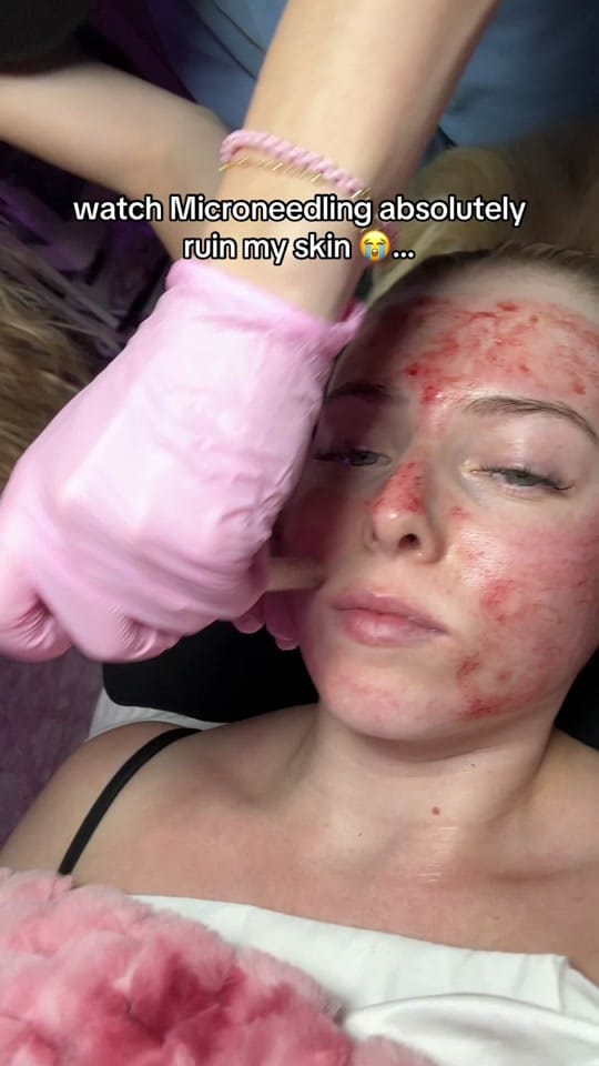 Post 7 by Madi Duvalois | UT Esthetician on TikTok (video)