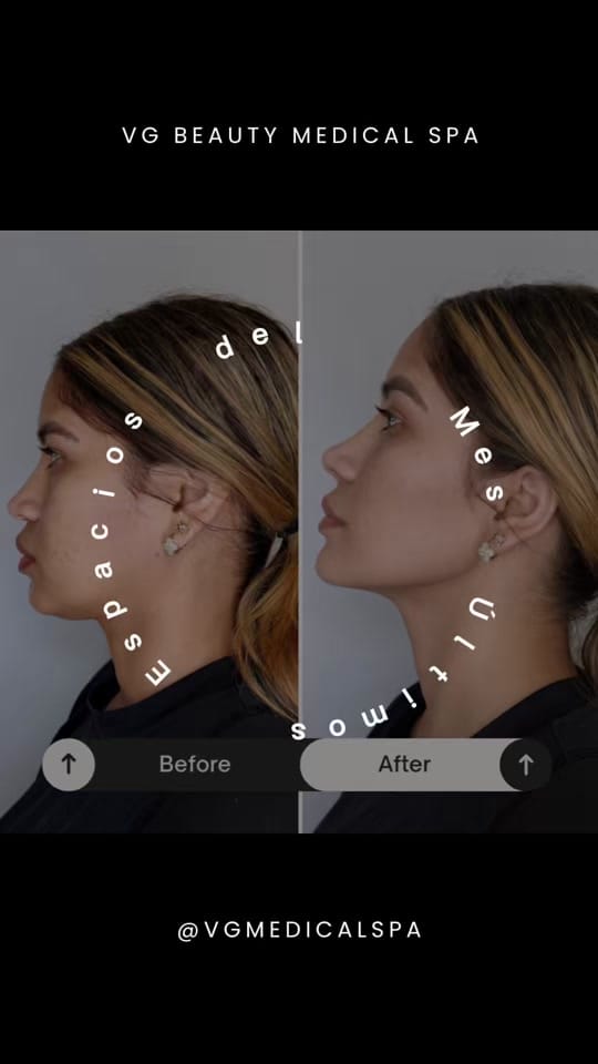 Post 9 by VG SPA 🧘🏼‍♀️ on TikTok (video)