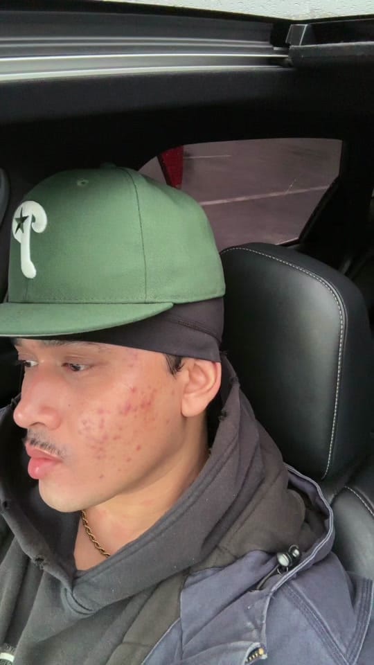 Post 7 by JUSTIN LY on TikTok (video)