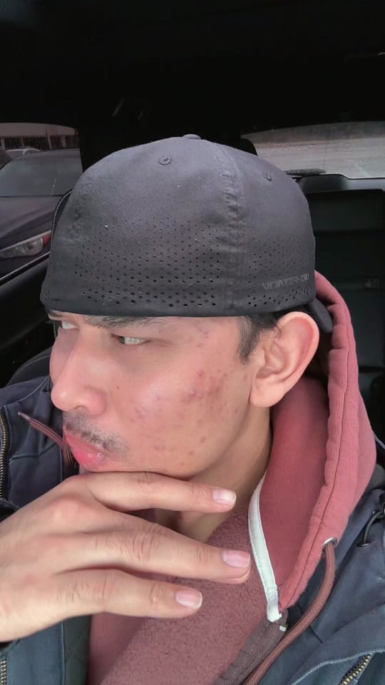Post 6 by JUSTIN LY on TikTok (video)