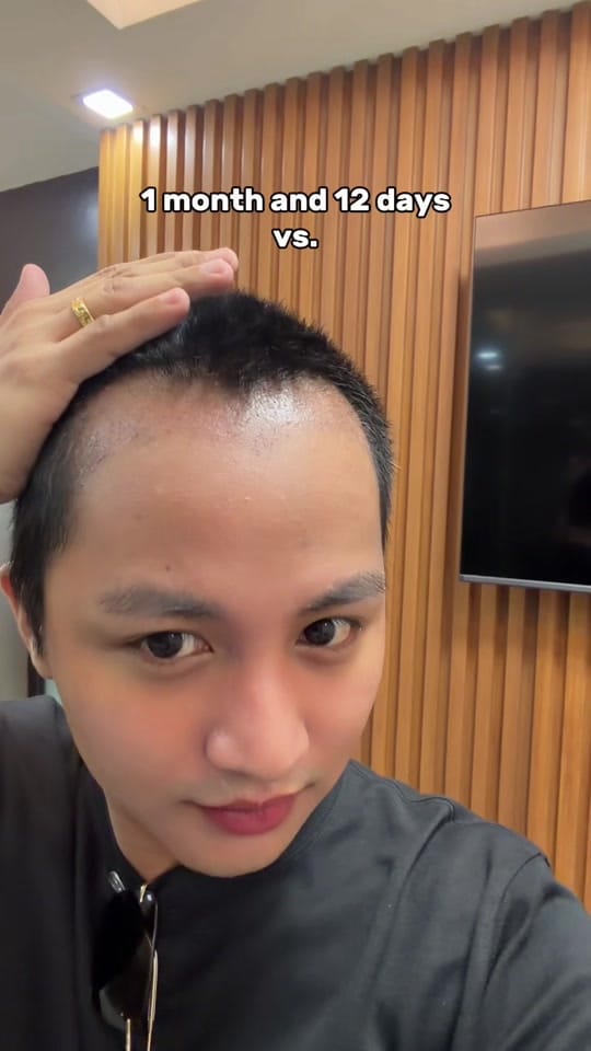 Post 1 by Arizon Tumaliuan Antonio on TikTok (video)