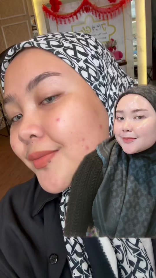 Post 8 by JGLOW SKINCARE AGEN PUSAT on TikTok (video)