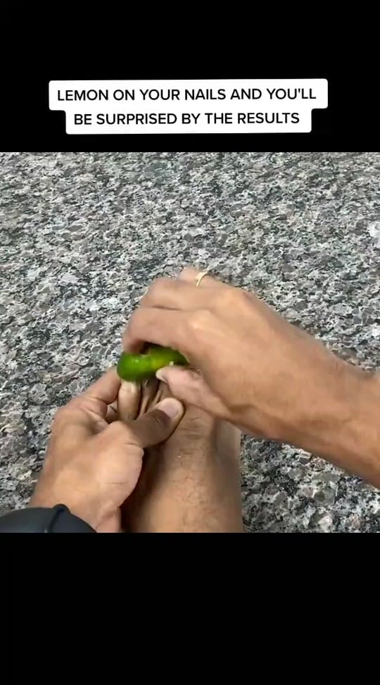 Post 8 by Mobigbold💯 on TikTok (video)