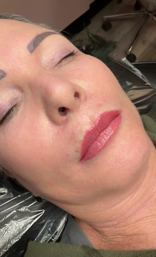 Post 4 by Skin Deep Esthetics on TikTok (video)