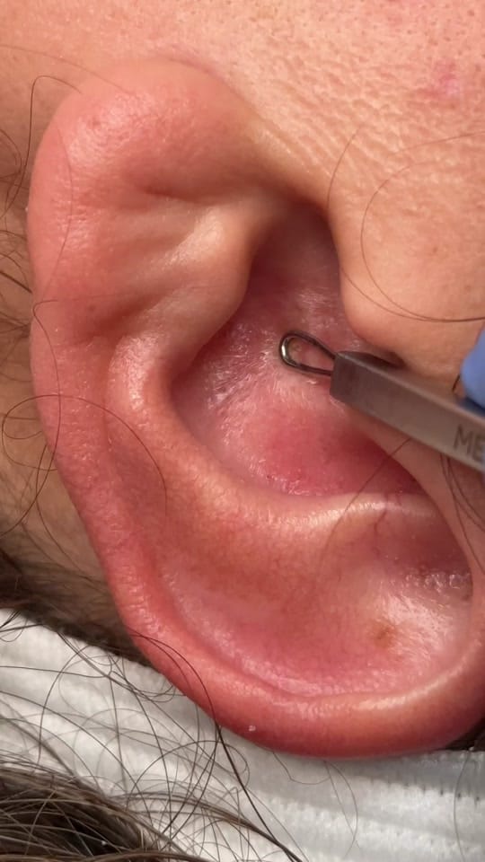 Post 9 by Ventura Esthetician on TikTok (video)