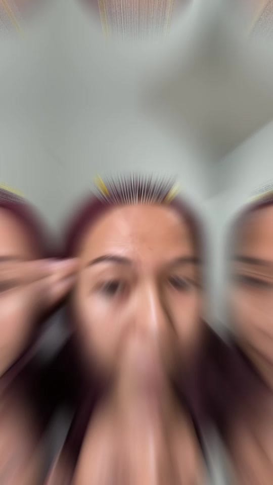 Post 8 by andine | kusam & oily skin on TikTok (video)