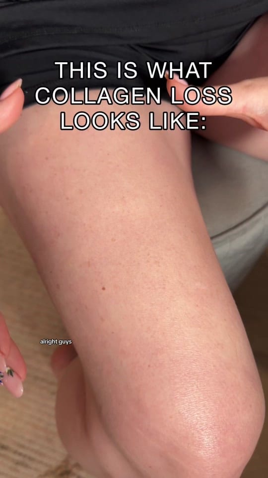 Post 9 by SavvyDerm on TikTok (video)
