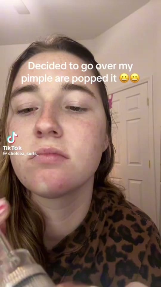 Post 2 by SavvyDerm on TikTok (video)