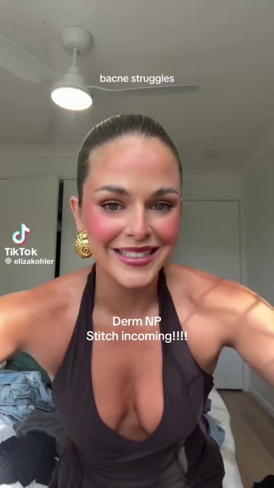 Post 7 by SavvyDerm on TikTok (video)