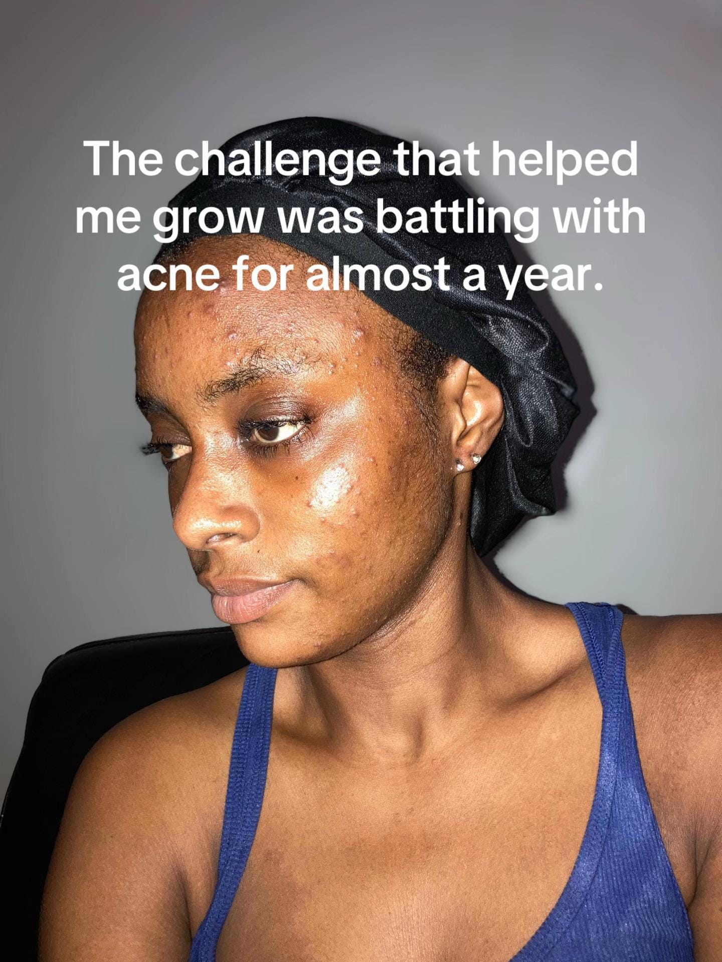 Post 9 by Dodo’s SkinCare 🇬🇲 on TikTok (video)