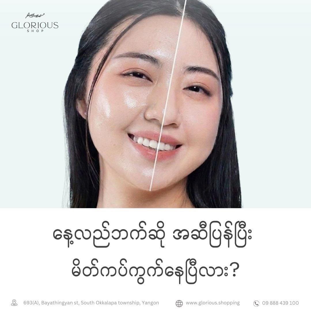 Post 1 by Glorious Shop Myanmar on TikTok (video)