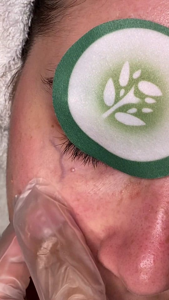 Post 8 by NM SkinCare Beauty on TikTok (video)