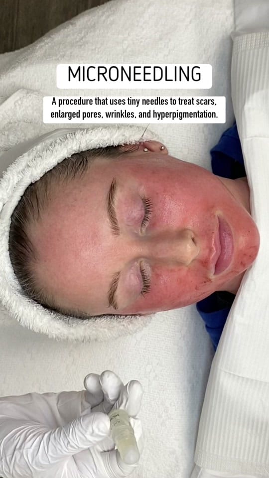 Post 7 by NM SkinCare Beauty on TikTok (video)