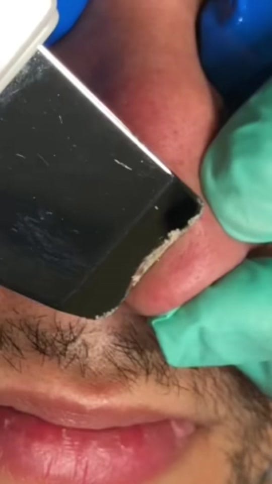 Post 1 by NM SkinCare Beauty on TikTok (video)