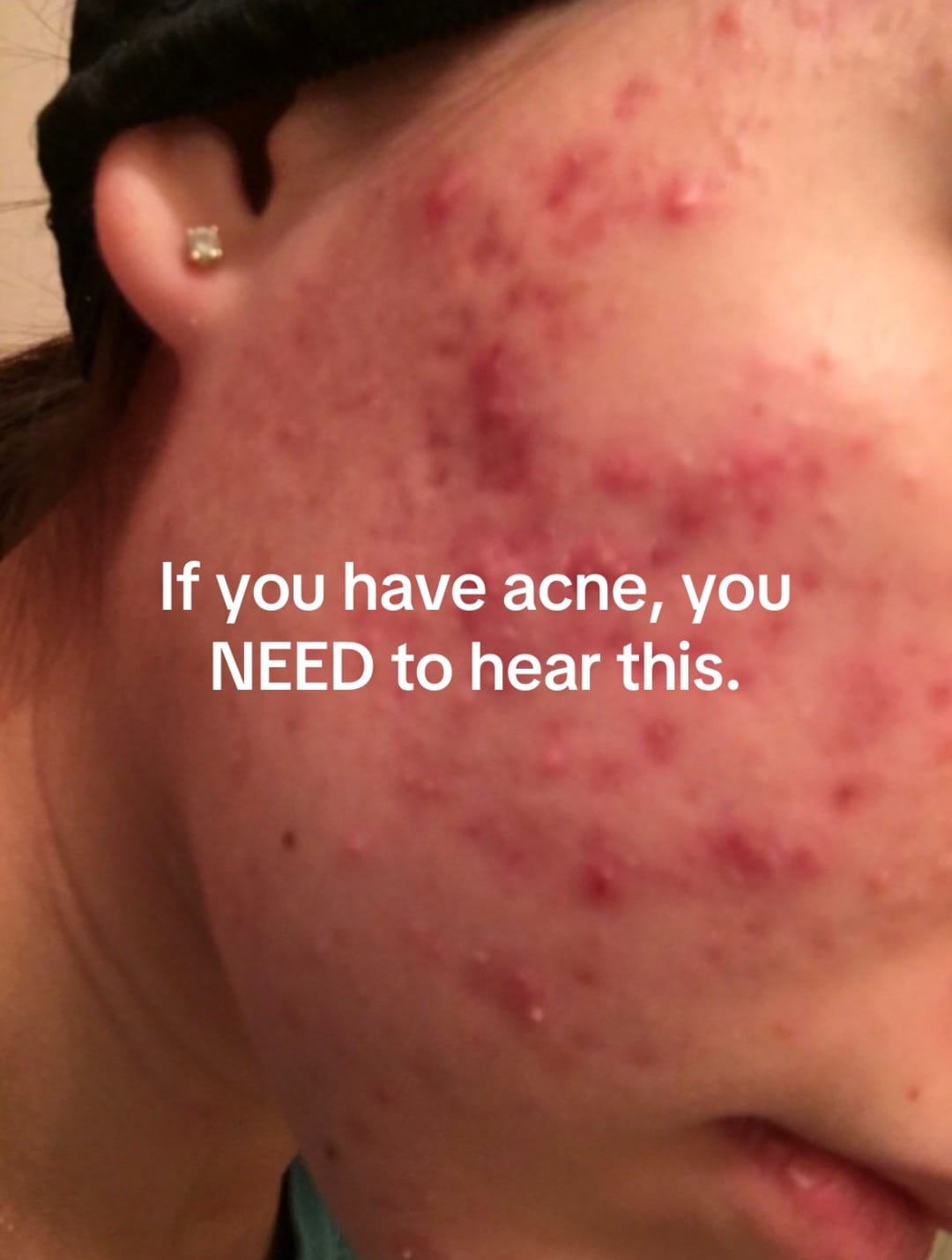Post 8 by Zoe The Esthetician on TikTok (video)