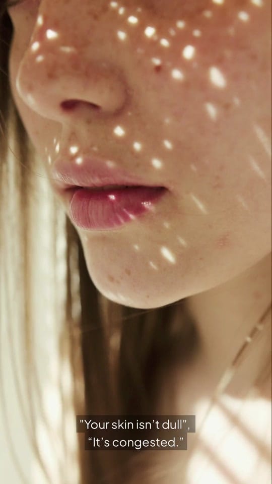 Post 1 by HaisonSkin | Glow Boosting on TikTok (video)