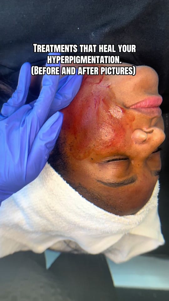 Post 3 by Rare Artistry Skincare on TikTok (video)