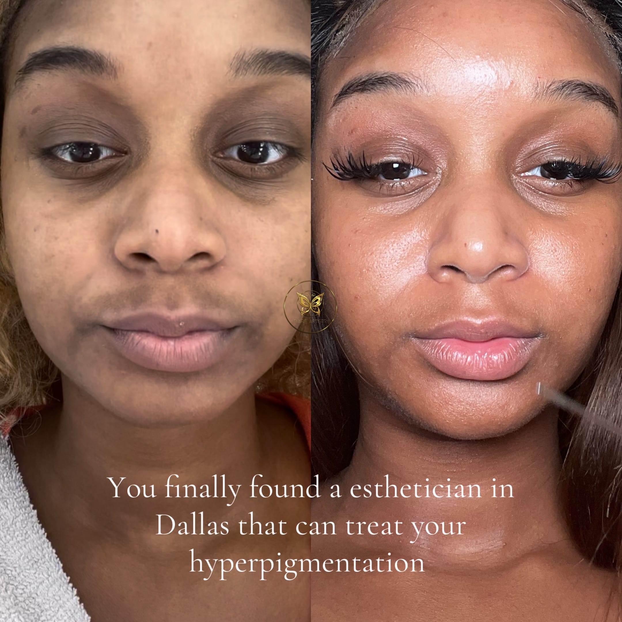 Post 9 by Rare Artistry Skincare on TikTok (video)