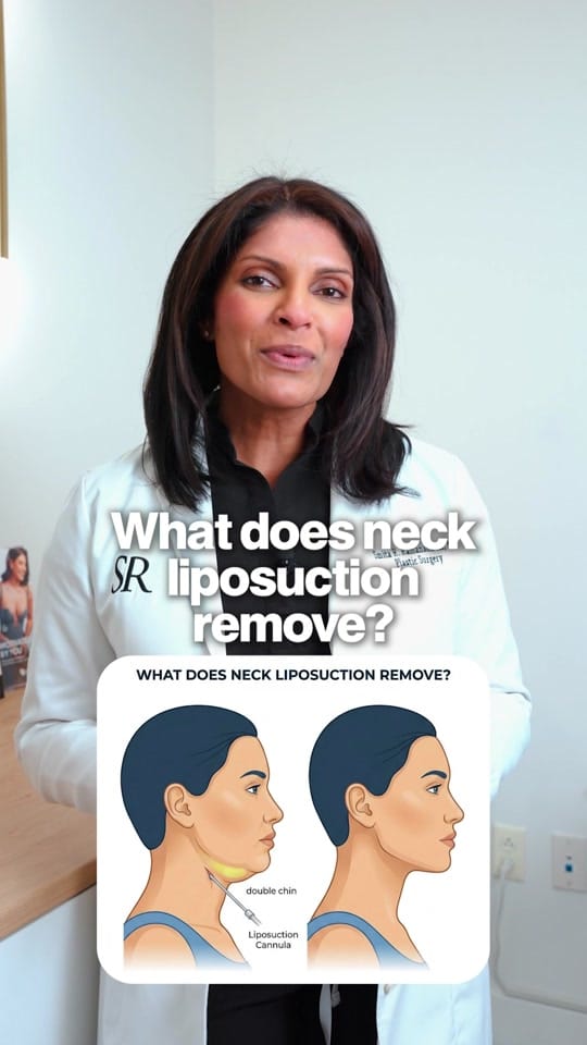 Post 4 by Smita Ramanadham, MD on TikTok (video)