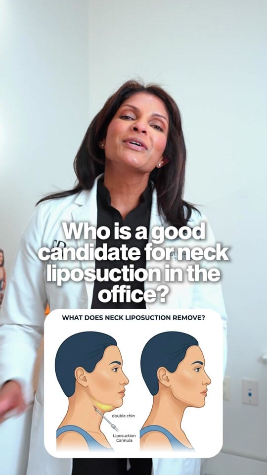 Post 7 by Smita Ramanadham, MD on TikTok (video)