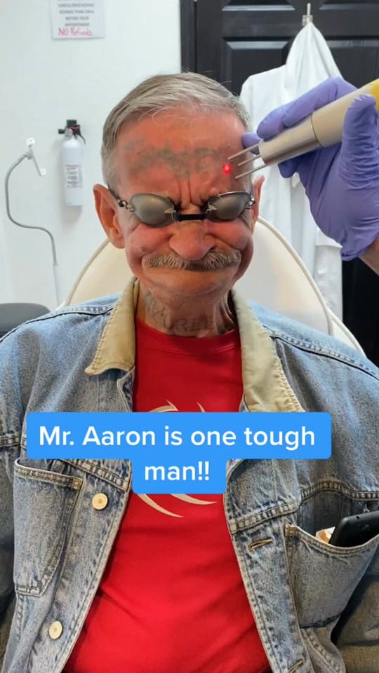 Post 10 by Clear Out Ink Tattoo Removal on TikTok (video)