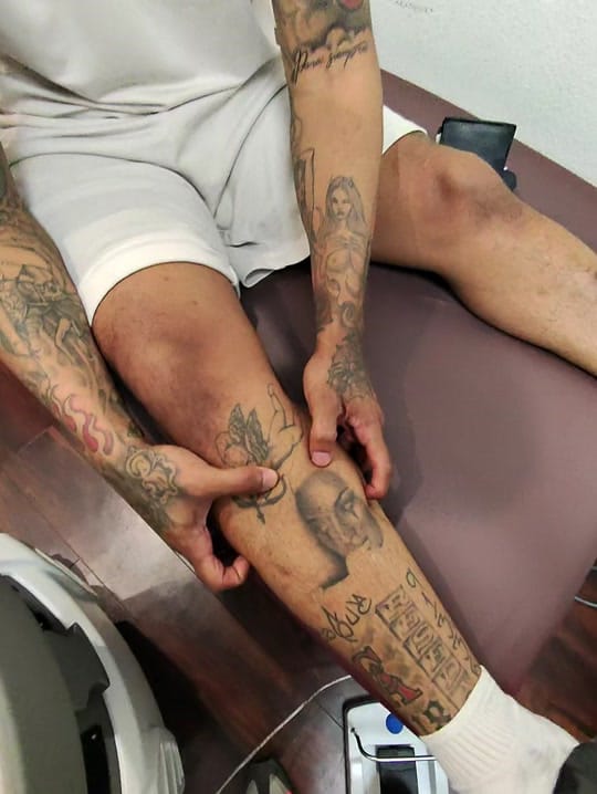 Post 2 by Clear Out Ink Tattoo Removal on TikTok (video)