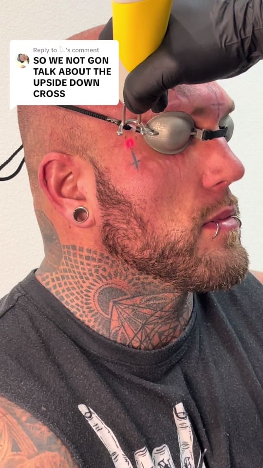 Post 9 by Clear Out Ink Tattoo Removal on TikTok (video)