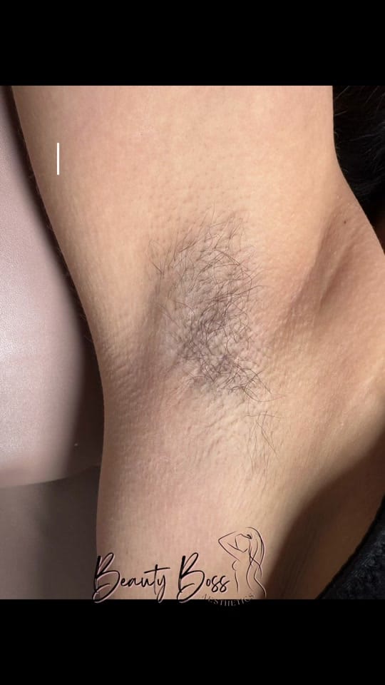 Post 4 by BeautyBossAesthetics on TikTok (video)